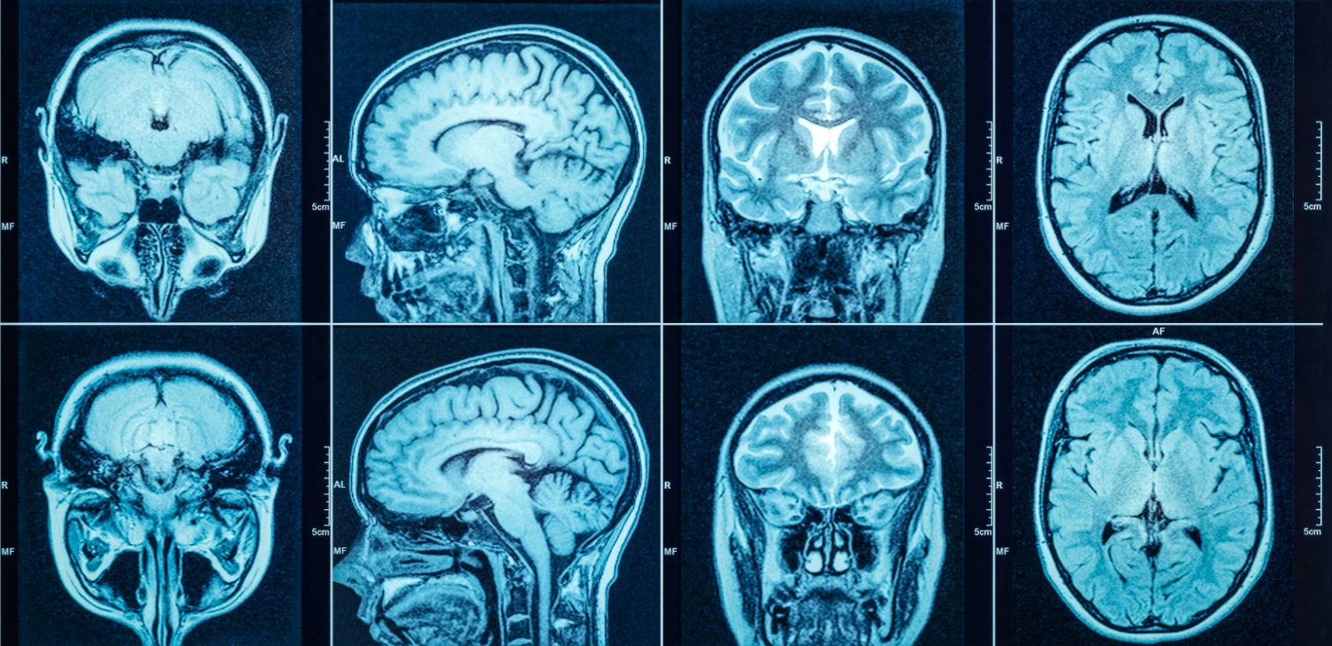 وفر حتى 50% على فحوصات الأشعة مع آدم سكان